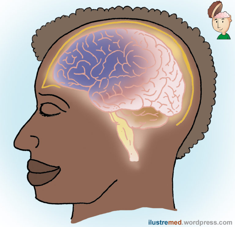 Quais S O Os Primeiros Sintomas Do Tumor Cerebral Tumor Cerebral